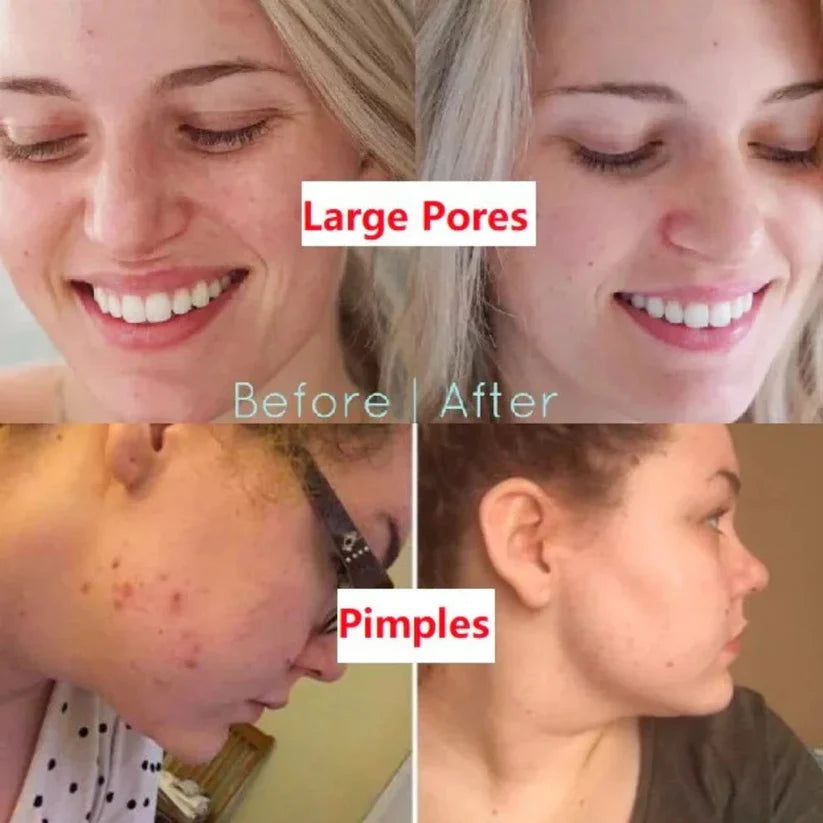Vyrnexa™  100% Natural Green Tea Deep Cleanse Mask